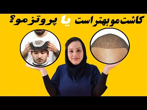 کاشت مو تهران