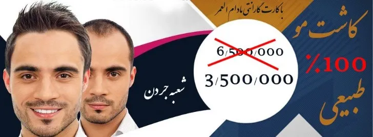 کاشت مو تهران