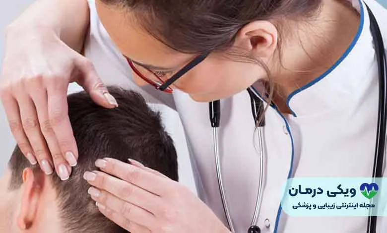 کاشت مو تهران